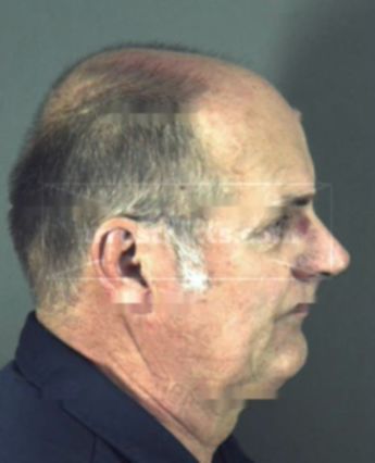 Michael A Dewitt