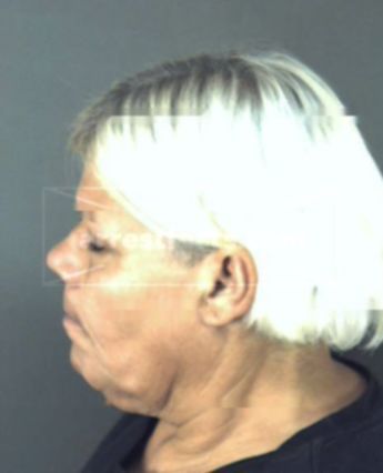Hilda Janet Medina