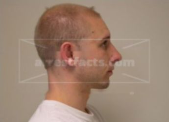 Brandin L Glass