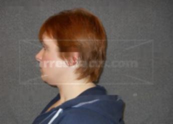 Nicole L Halbach