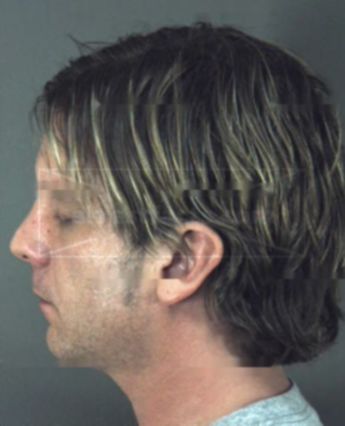 Clinton Douglas Munn