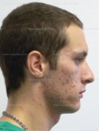 Zachary J Hoselton
