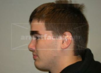 Ryan J Fryza