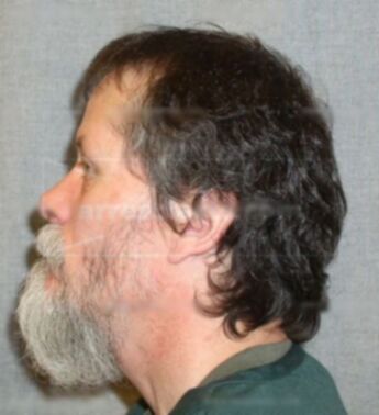 Keith A Davis
