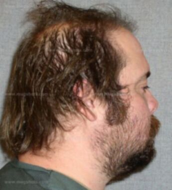 Jay Jay L Neubauer