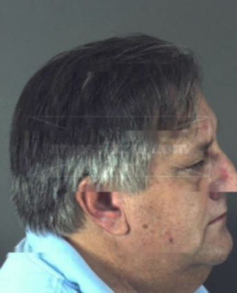 Richard Allan Burnside
