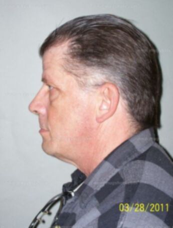 Randy Nelson