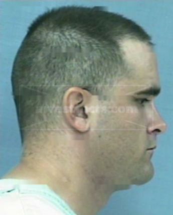 Derick K Swartz