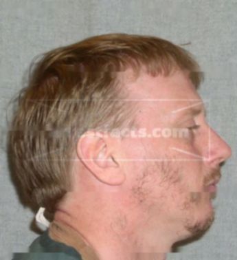 Larry J Kauther