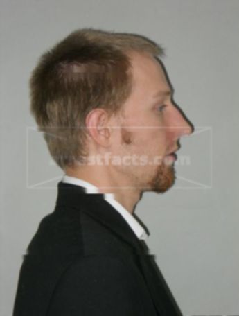 Ryan A Wehrwein