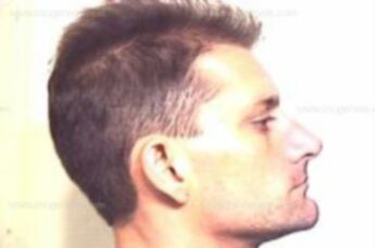 Anthony Shane Losak