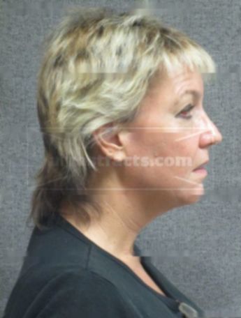 Tammy L Klapper Kaderly