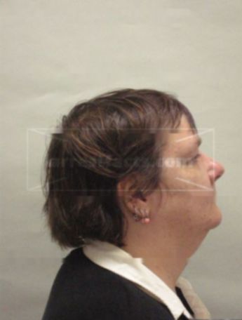 Deborah Mosing