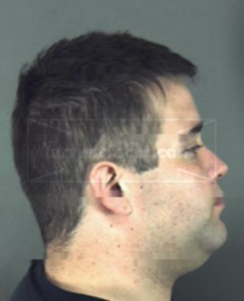 Michael Daniel Collar