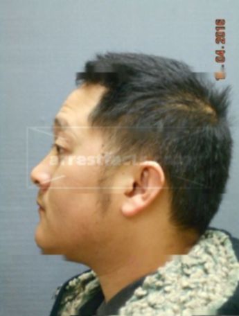 Ber Vang