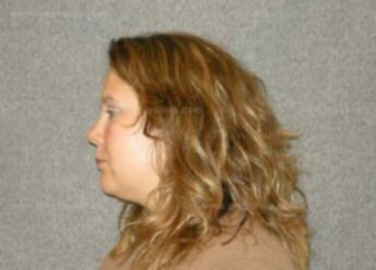 Tammy L Meyers