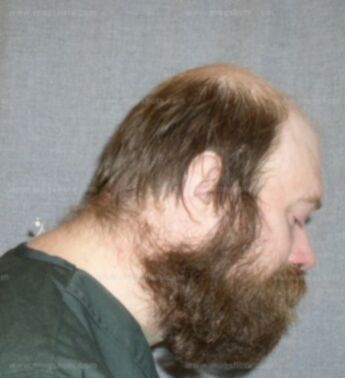 Patrick Zurkowski
