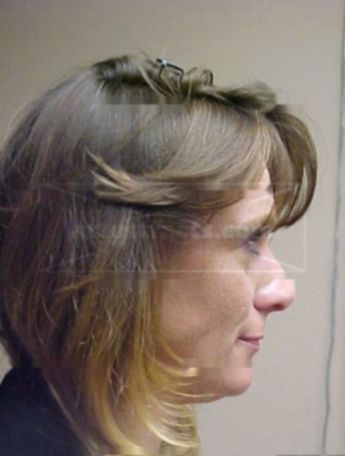 Ladonna Pilkington