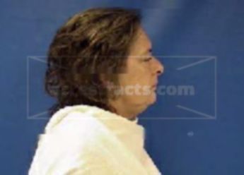 Shirley Hall Speed