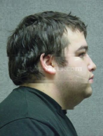 Walter J Lemieux Iii