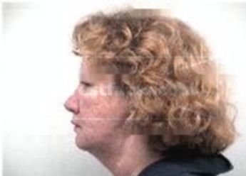 Susan Dirmeyer Kirk