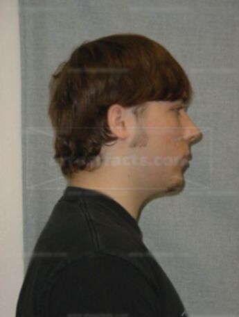 Joshua J Erdman