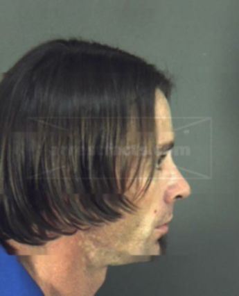 Craig Alan Mcdonald