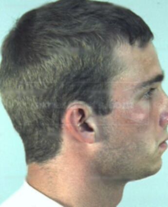 Ryan Allen Cain