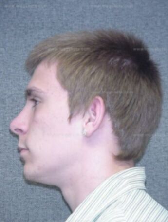 Jacob J Peterson