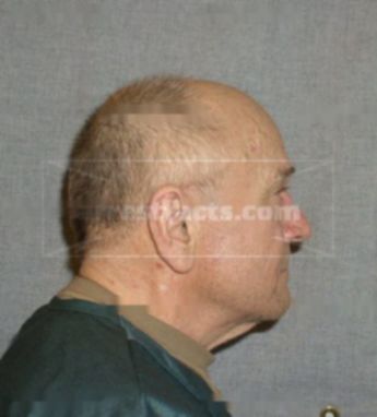Jack A Kasprzak