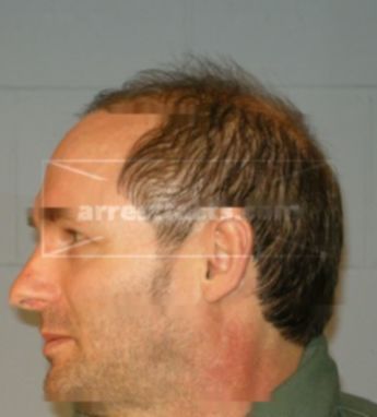 Gene M Engel