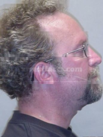 Jeffrey A Johnson