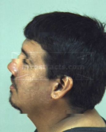 Jose Antonio Gonzales