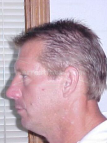 Steven D Unruh