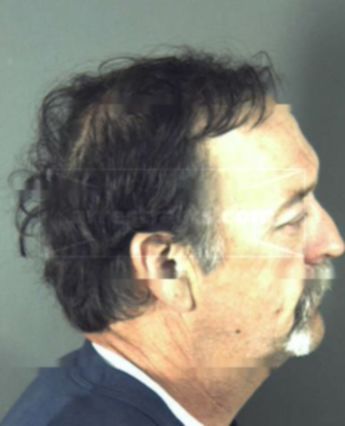 Michael Brent Campfield