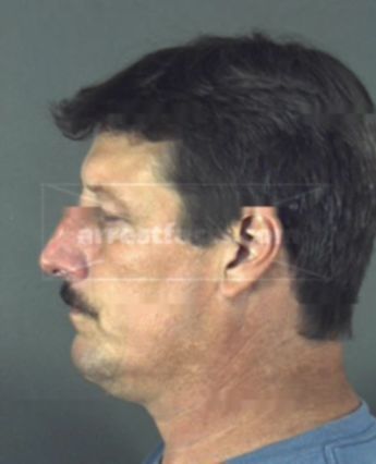 Robert Craig Smigel