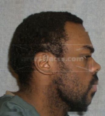 Napoleon Moore