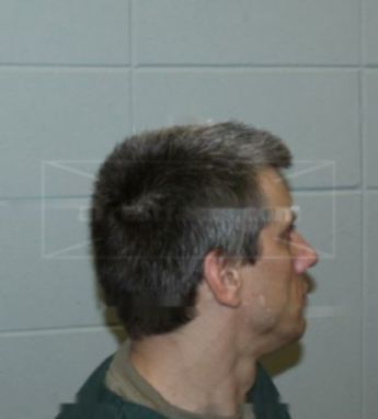 Steven T Thyssen