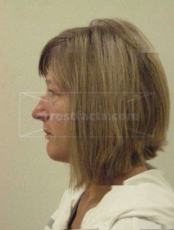 Barbara L Peeters