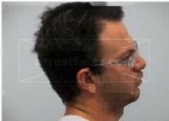 Jason Alexander Gilgor