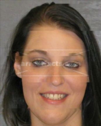 Allison Shaw