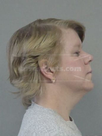 Christine J Osborne