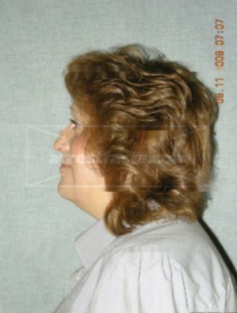 Christine M Barnard