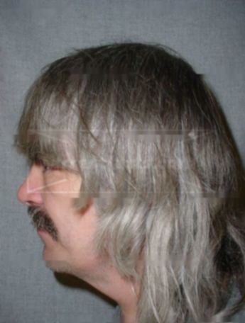 Michael W Shinkan