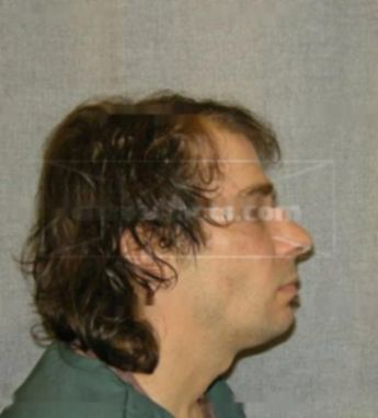 Michael Broetzmann