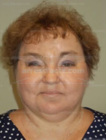 Trisha J Pieper