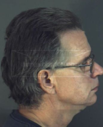 Craig A Weber