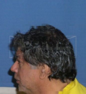 David Romero