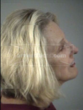 Patricia Brockman Prete