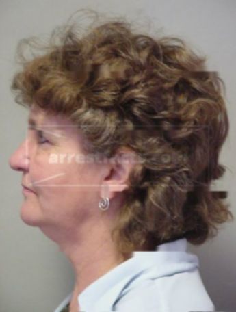 Linda L Fosberg